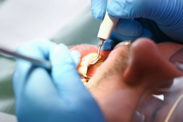 Best Emergency Dental Surgery in Venersborg, WA