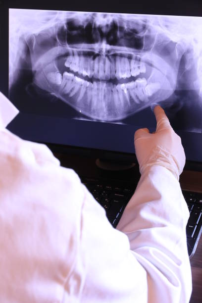 Best Emergency Tooth Extraction in Venersborg, WA