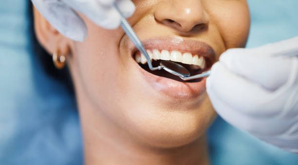 Best Emergency Wisdom Teeth Removal in Venersborg, WA